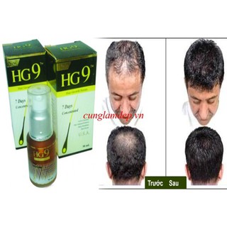 Serum Mọc Tóc Hiệu Quả HG9