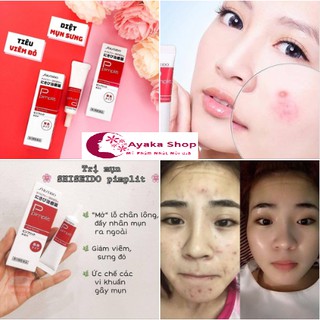 Kem ngăn ngừa mụn Shiseido Pimplit 18g Chuyên Cho Mụn Bọc Mụn Sưng -Mỹ Phẩm Nhật Nôi Đia AyakaShop.