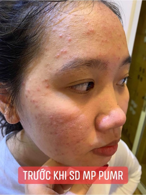 Cốt nhân sâm và kem face tối pumr