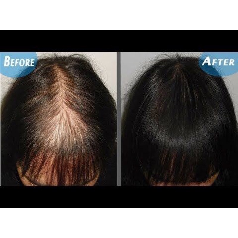 Bột nhân sâm kích thích mọc tóc | BigBuy360 - bigbuy360.vn