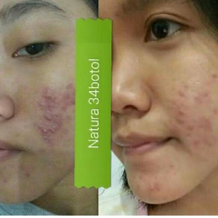 Bình Xịt Làm Đẹp Tự Nhiên 100%EF39 (Trims,.) | BigBuy360 - bigbuy360.vn