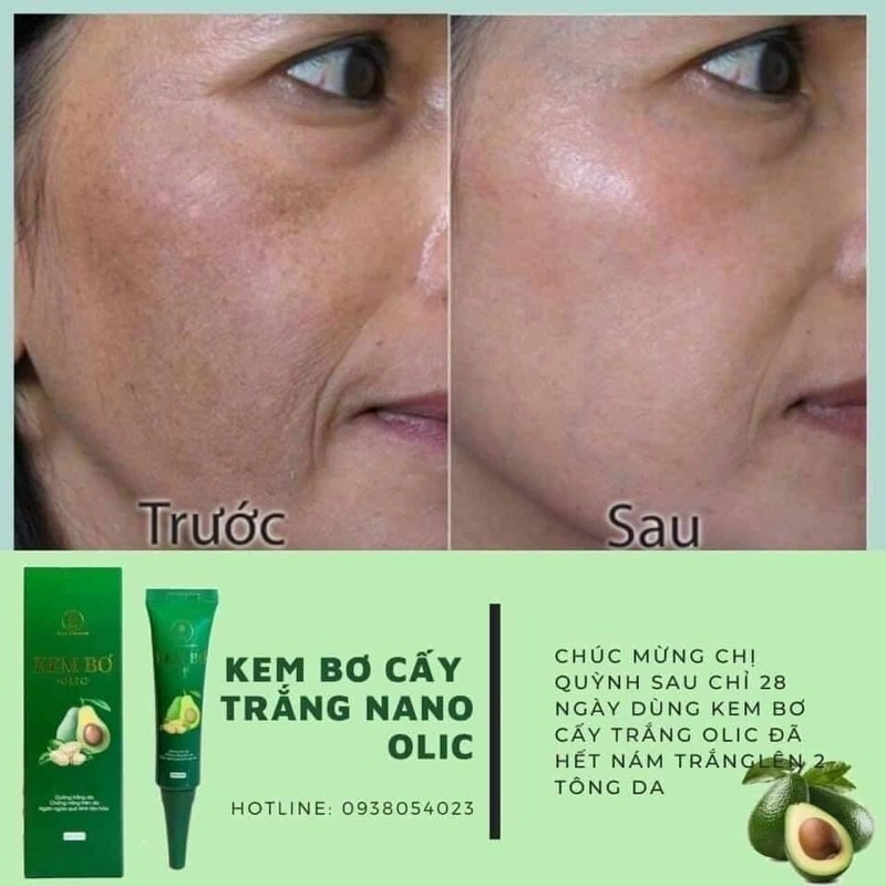 [ CHÍNH HÃNG ] KEM BƠ CẤY TRẮNG NANO OLIC MẪU MỚI— MỜ NÁM , TÀN NHAN