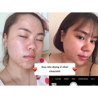Tẩy trang Chacott Nhật