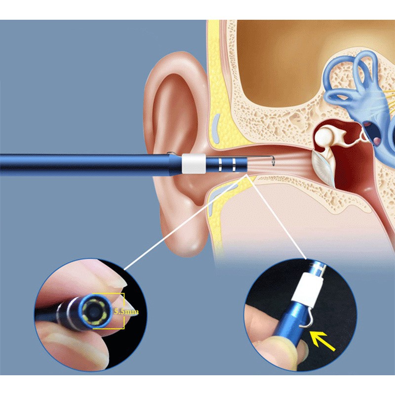 Dụng Cụ Lấy Ráy Tai Thông Minh, Camera Nội Soi Tai Siêu Nét Đi Kèm Bộ Đầu Lấy Ráy Chống nước  chuẩn IP67 - 1 ĐỔI 1