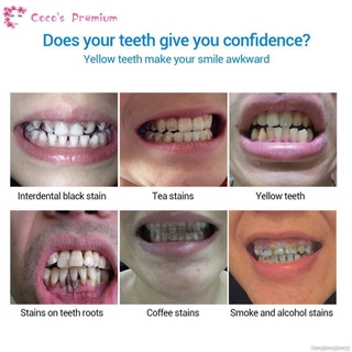 (Hàng Mới Về) Serum Làm Trắng Răng Sạch Sẽ Chất Lượng Cao