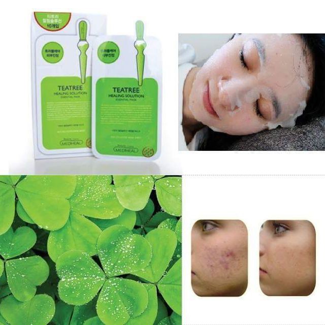 Hộp 10 Mặt nạ giảm mụn trà xanh Mediheal Teatree Healing solution Essential Mask