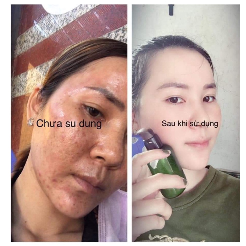 Combo 3 Chai Serum Tái Tạo Da Sâm Cao Rừng MQ SKIN