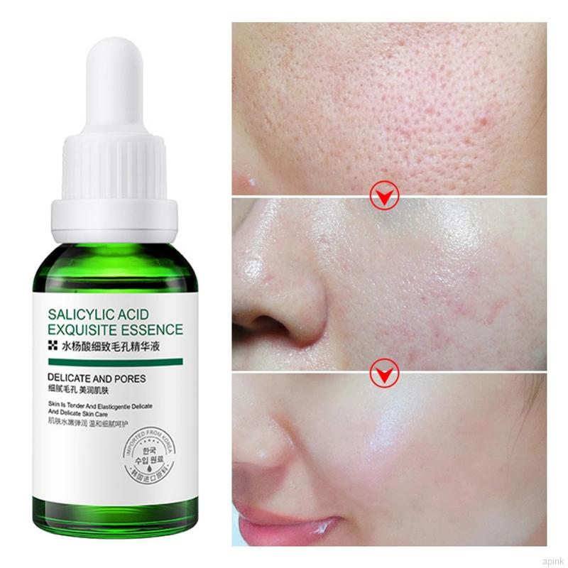 Serum tinh chất dưỡng da mặt 30ml se khít lỗ chân lông làm mịn làm trắng da dưỡng ẩm chống lão hóa