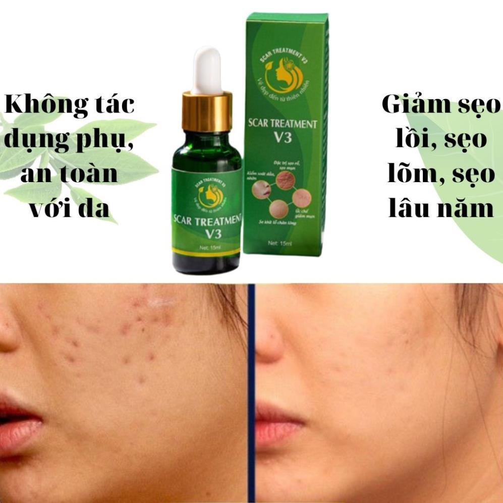 Tinh chất serum hỗ trợ sẹo lâu năm-Inviscar Streatment 15ml-Hiệu quả nhanh-Không gây kích ứng