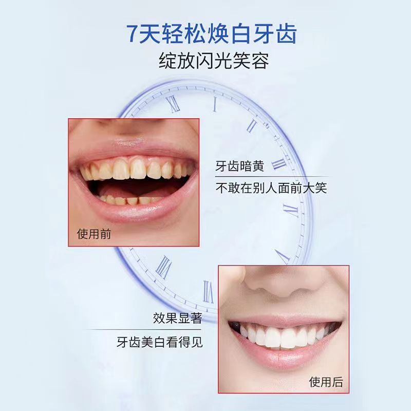 Miếng Dán Làm Trắng Răng 3D Tiện Dụng Chất Lượng Cao