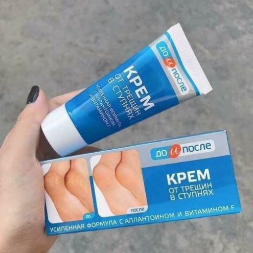 Kem Nứt Gót Chân ❤️𝑭𝒓𝒆𝒆𝒔𝒉𝒊𝒑❤️ Kem Ngăn Ngừa Và Hồi Phục Nứt Nẻ Gót Chân Kpem Nga 50ml