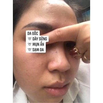 Peel da thay da sinh học tẩy tế bào chết giảm thâm sạm dùng cho mặt lưng nách vi tảo thảo mộc LUXI SKIN Sample 5ml