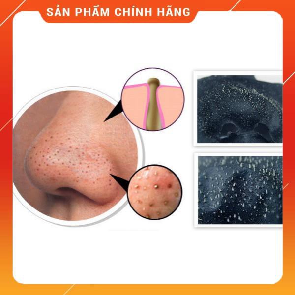 Lột Mụn Than Tre Và Trà Xanh , cam , cà phê