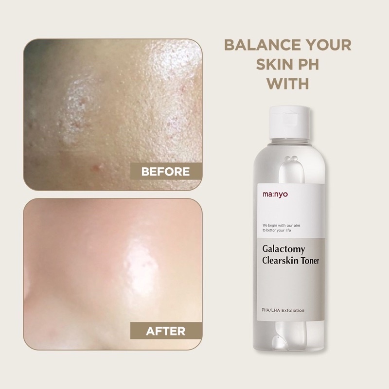 Nước cân bằng da MANYO GALACTOMY CLEARSKIN TONER