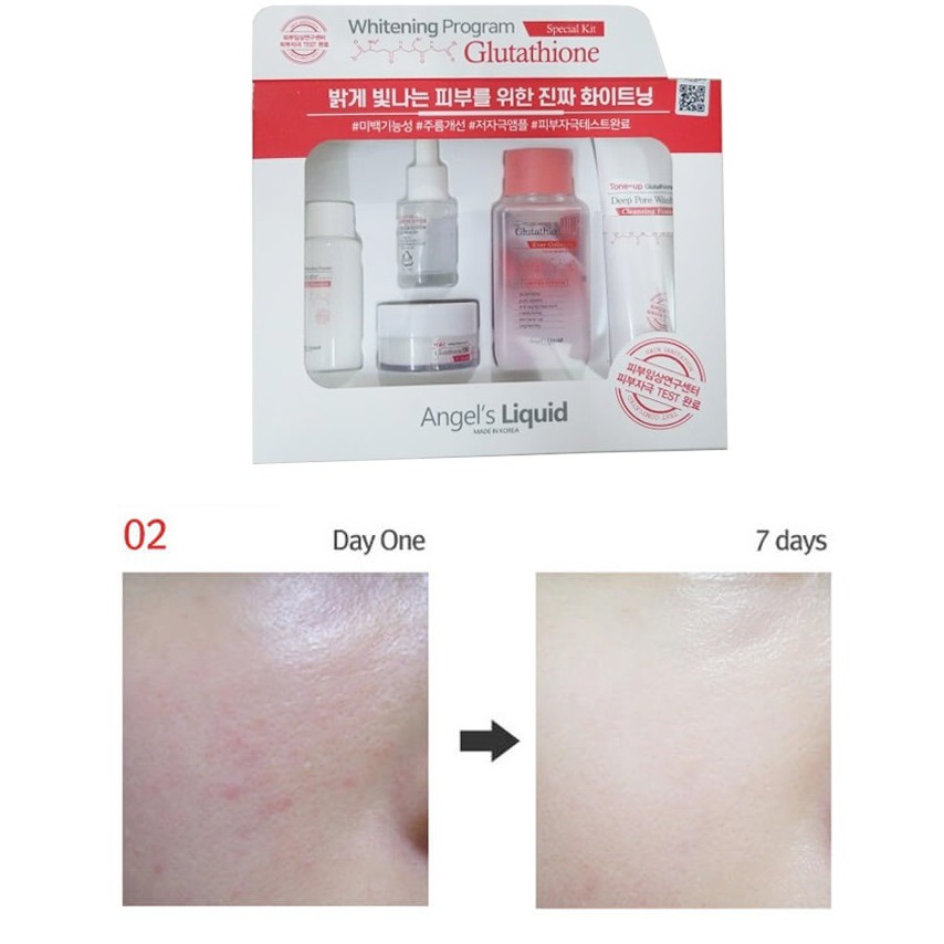 Bộ kit 5 món Dưỡng Trắng Da, Làm Mờ Thâm Angel's Liquid Whitening Program Special Kit Glutathione | BigBuy360 - bigbuy360.vn