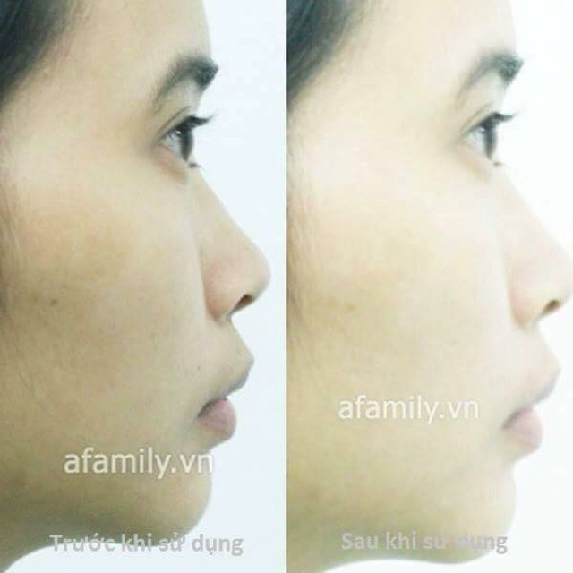 Kem giữ ẩm da vitamin E