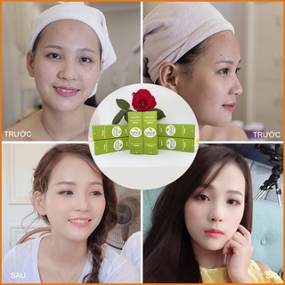 Serum trị thâm mụn - thâm môi - thâm nách - thâm do côn trùng đốt - thâm chân tay - nách - hết thâm sau 2 tuần sử dụng