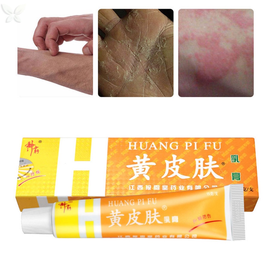 Kem Thảo Dược Hỗ trợ giảm vẩy nến / Chàm Chống Ngứa Hiệu Quả