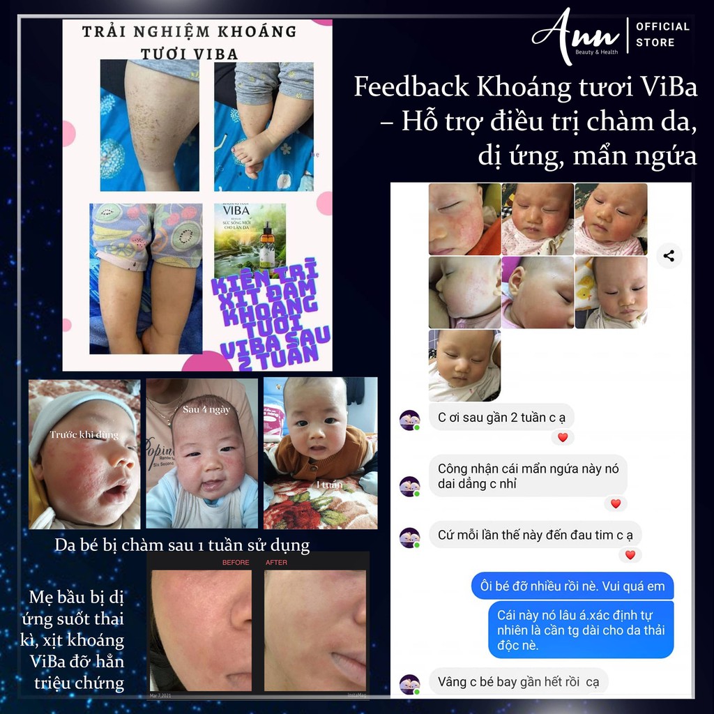 Xịt khoáng tươi ViBa 250ml cấp ẩm, dưỡng da, làm dịu, cân bằng da – Đại lý chính hãng Annshop | BigBuy360 - bigbuy360.vn