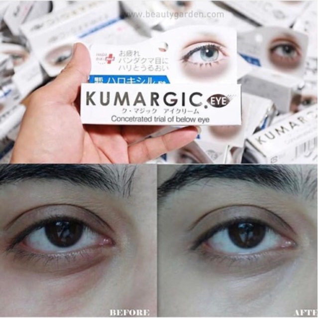 Kem Kumargic Eye 20g của Nhật Hỗ Trợ Cải Thiện Thâm Quầng Mắt