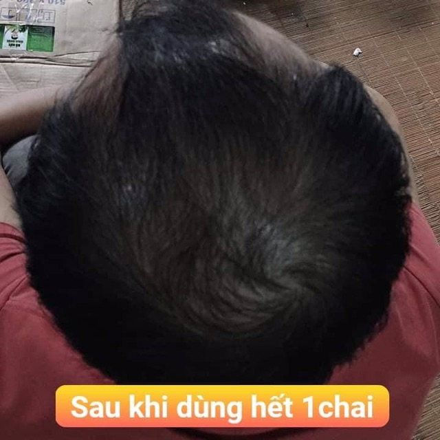 Dầu gội bồ kết hoa bưởi gàu-rụng tóc | BigBuy360 - bigbuy360.vn