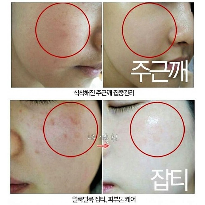 Kem Nám Melasma-X 3D Whitening Clinic