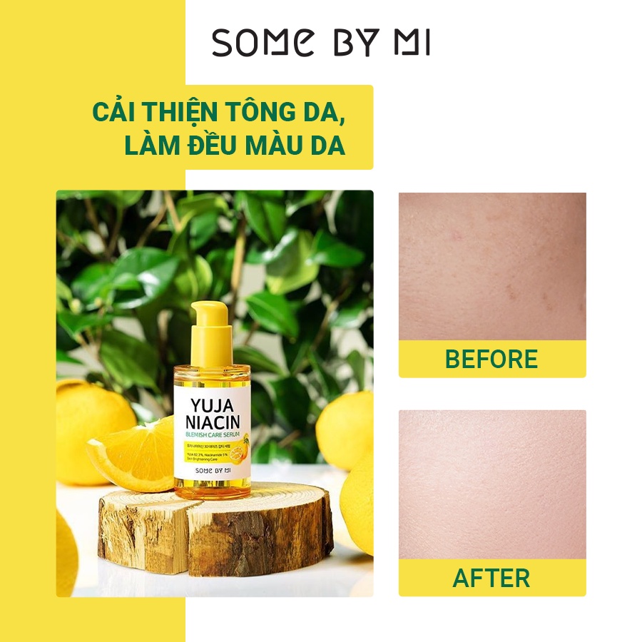 Tinh Chất Dưỡng Trắng Chiết Xuất Quả Thanh Yên SomeByMi Yuja Niacin 30 Days Blemish Care 50ml