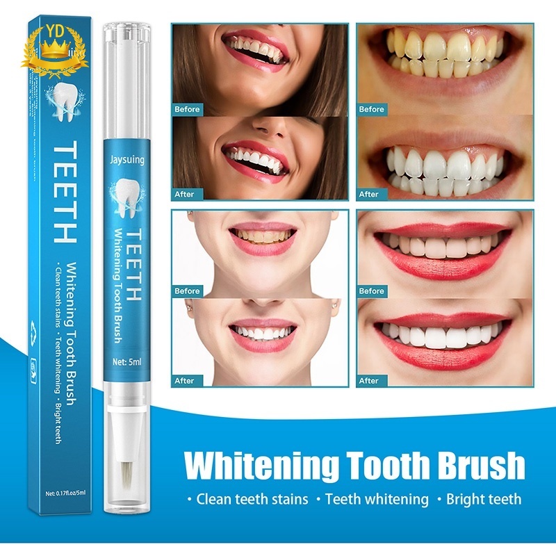 Bút Gel Tẩy Trắng Răng Hiệu Quả