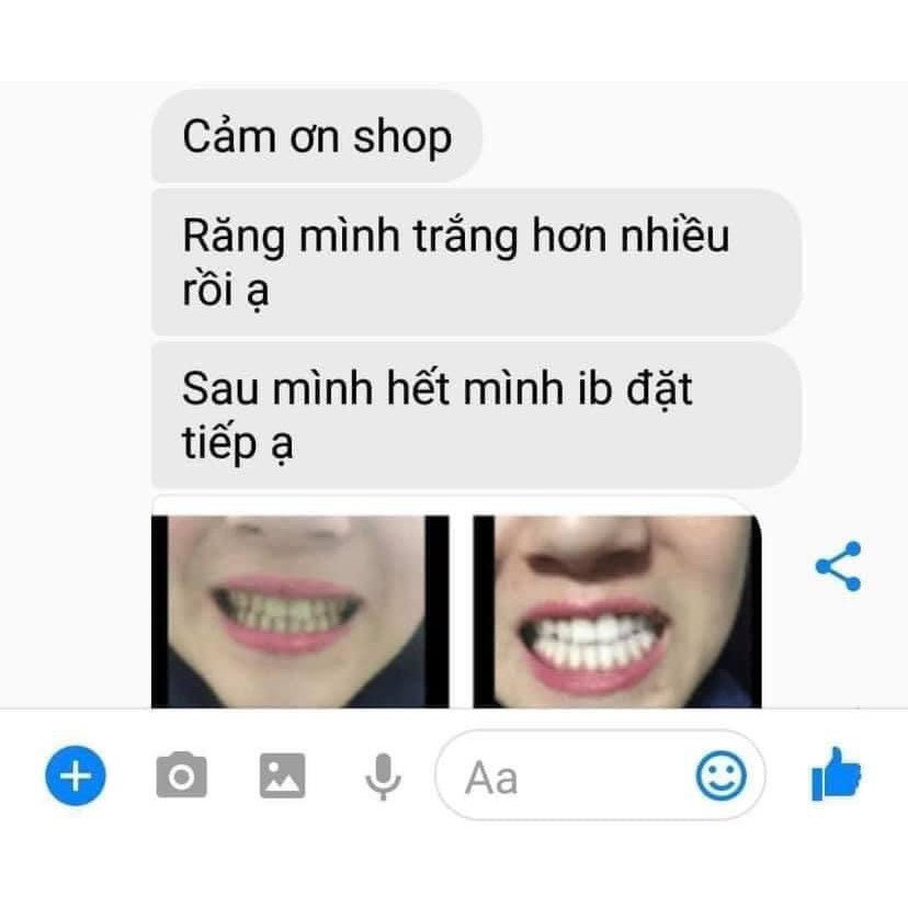 Bộ kit làm trắng răng tại nhà MAGIC SMILE nhập khẩu, tiêu chuẩn Châu Âu, hiệu quả, tiện lợi - Shop Tiện Ích Vượt Trội