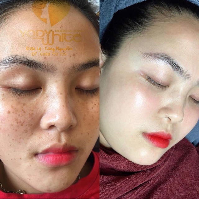 KEM DƯỠNG TRẮNG DA TÁI TẠO BAN ĐÊM SU SKIN