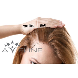 Serum kích mọc tóc Aveline công nghệ Mỹ,💥HÀNG CAO CẤP CHÍNH HÃNG💥 kích tóc mọc nhanh, mọc rậm dày chắc khỏe bóng đẹp.