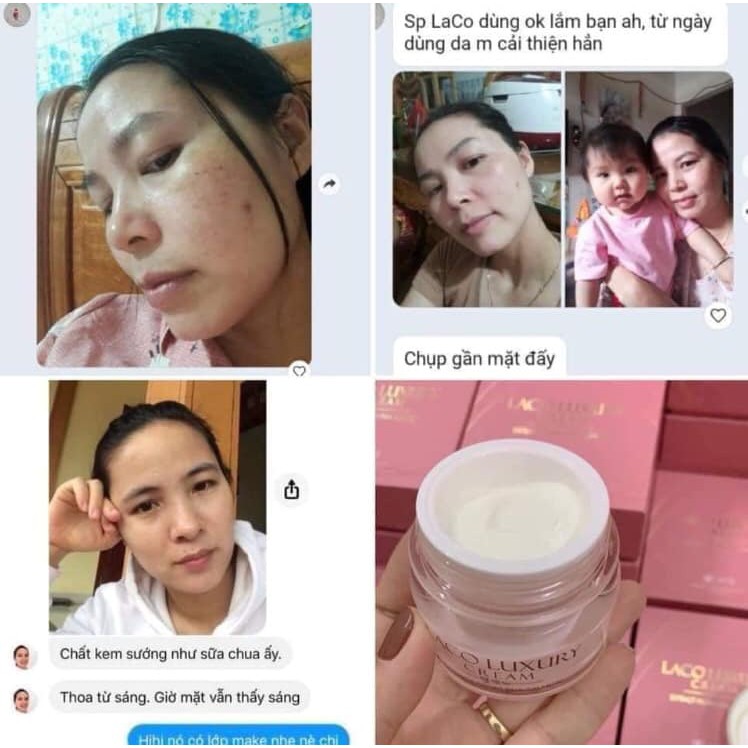 KEM NGÀY CREAM LUXURY