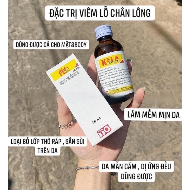 viêm lỗ chân lông kela lotion