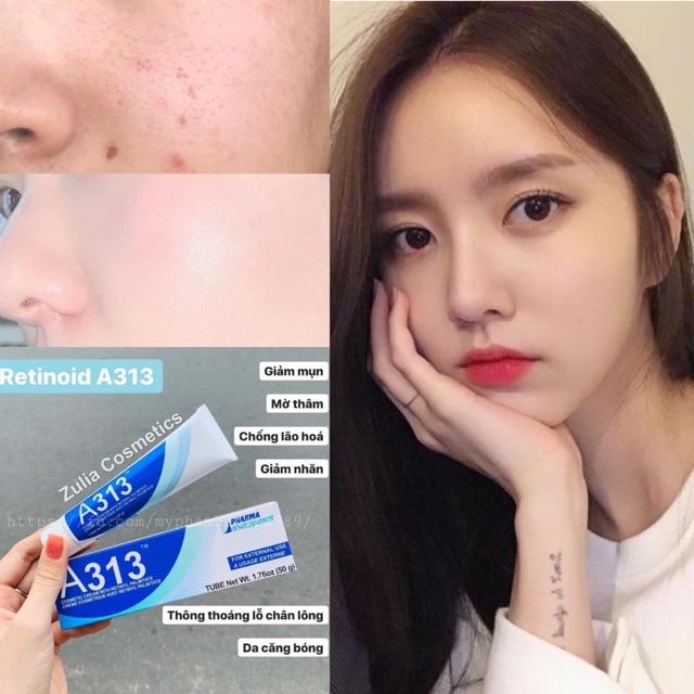𝑲𝒆𝒎 𝑹𝒆𝒕𝒊𝒏𝒐𝒍 𝑨313- 𝑻𝒓𝒊̣ 𝒎𝒖̣𝒏, 𝒔𝒆 𝒌𝒉𝒊́𝒕 𝒍𝒐̂̃ 𝒄𝒉𝒂̂𝒏 𝒍𝒐̂𝒏𝒈
