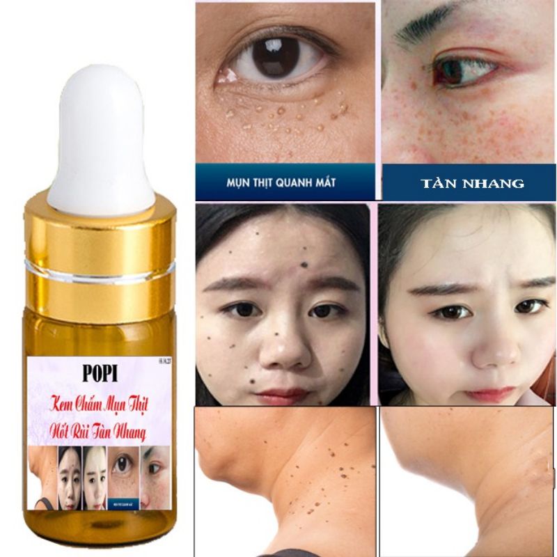 Kem Chấm Xóa Nốt Ruồi, Tàn Nhang, Thịt Dư, Mụn Cóc POPI