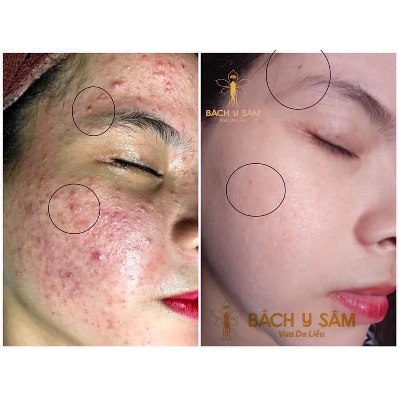 BÁCH Y SÂM 02PLUS 30ml | BigBuy360 - bigbuy360.vn