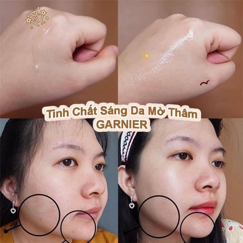 SERUM + KEM DƯỠNG GARNIER VITAMIN C Đức