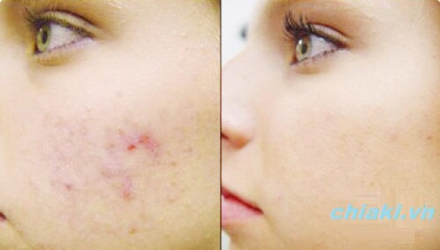 Nước Hoa Hồng Melano CC Nhật Bản | BigBuy360 - bigbuy360.vn