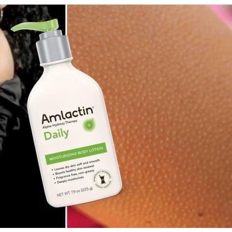 Lotion dưỡng da toàn thân Amlactic Daily Body Lotion 567gram