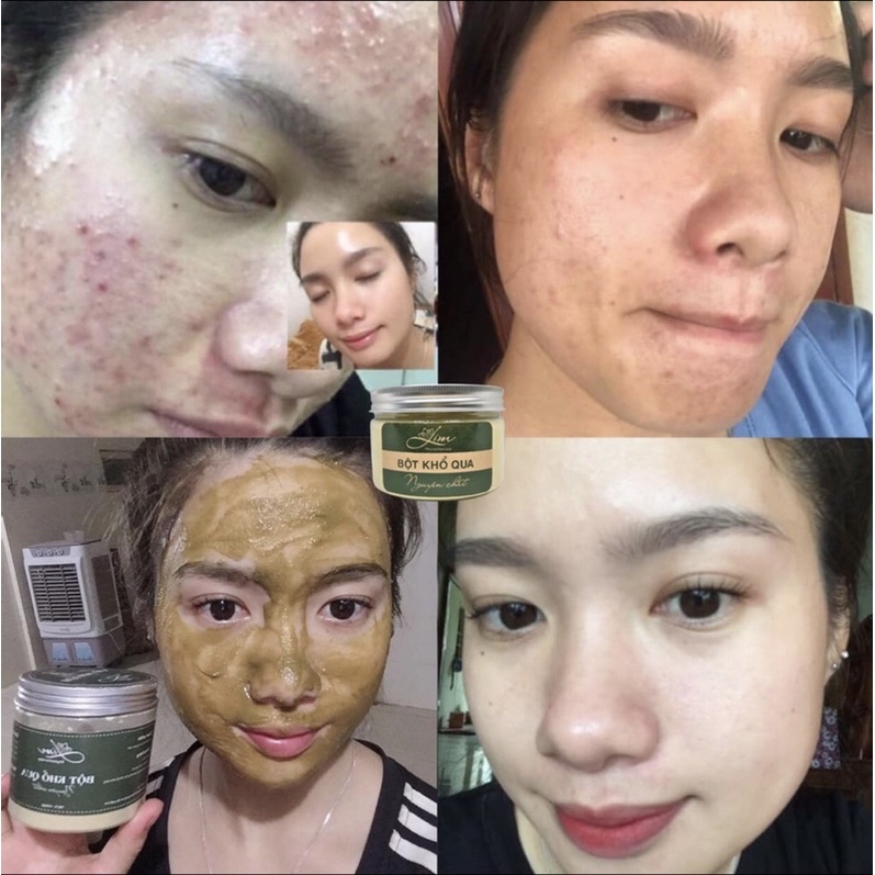 [Handmade] Bột khổ qua nguyên chất - 100% không pha trộn,giảm mụn, sáng da, chăm sóc da mặt hiệu quả | BigBuy360 - bigbuy360.vn
