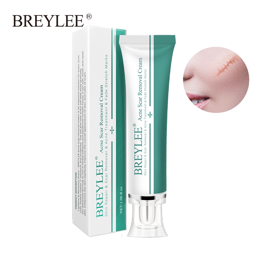 Có Hàng Breylee Gel Xóa Sẹo 30G Điều Trị Sẹo Mụn Xóa Vết Rạn Da Làm Trắng Thanh Toán Khi Nhận Hàng