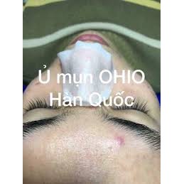 Ủ Mụn OHIO Hàn Quốc