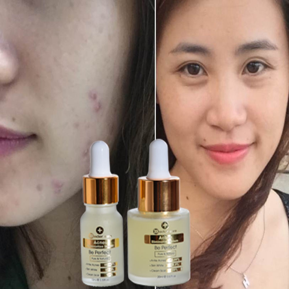 Serum TRI MUN cấp tốc 7 ngày liền sẹo mờ vết thâm Doctor Care