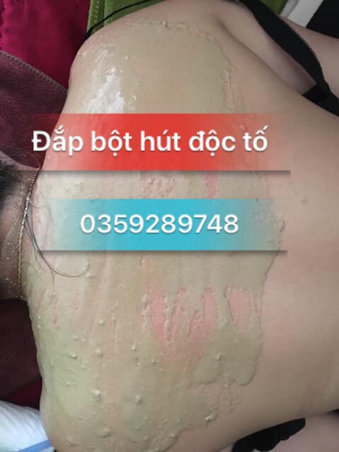 [ Đau đâu đắp đó]  Bột đắp đau xương khớp vai gáy, lưng eo | BigBuy360 - bigbuy360.vn