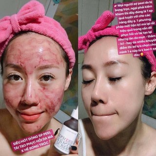 [TUÝT 20M] THAY DA SINH HỌC RED PEEL