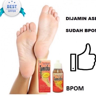 Dụng Cụ Loại Bỏ Bàn Chân Gãy Tumitsu BPOm Của Tôi