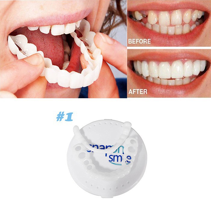 [FREESHIP] RĂNG GIẢ NHỰA SNAP ON SMILE (4885, LM)