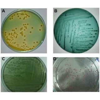 [COMBO] 20 ĐĨA TEST KHUẨN TÔM CHỨA THẠCH MÔI TRƯỜNG TCBS PHÂN LẬP VIBRIO