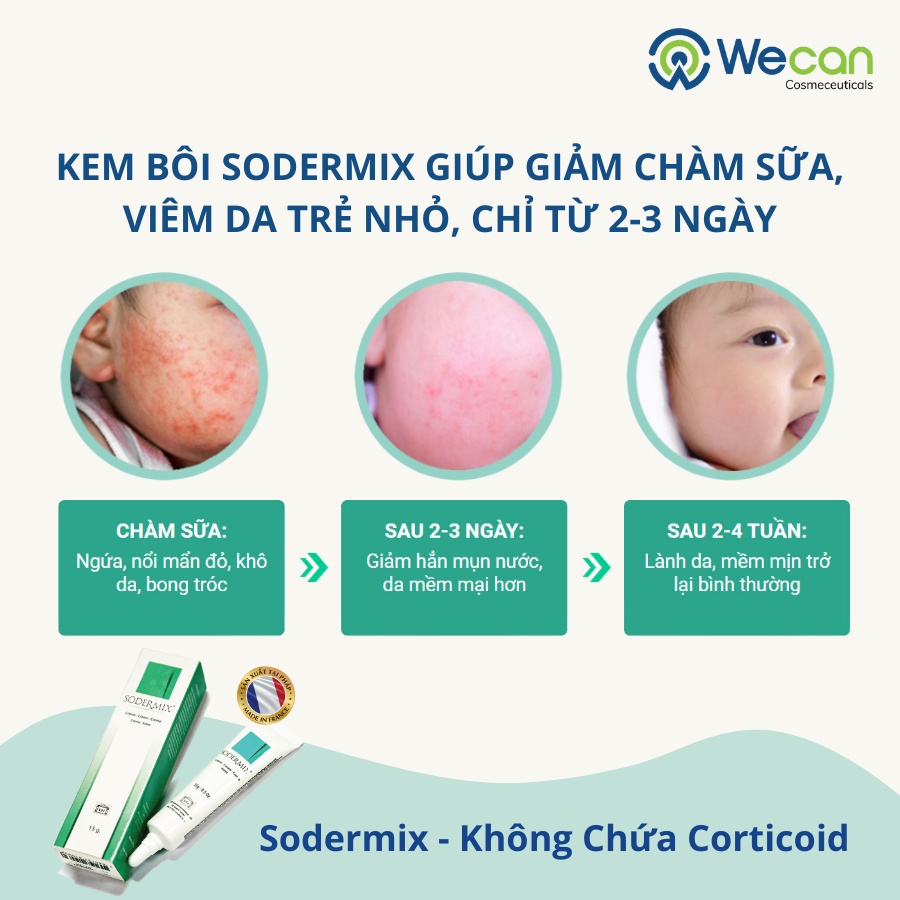 Kem Bôi Chàm Sữa Trẻ Nhỏ SODERMIX - Không Corticoid Nhập Khẩu Nguyên Hộp Từ Pháp 15gr