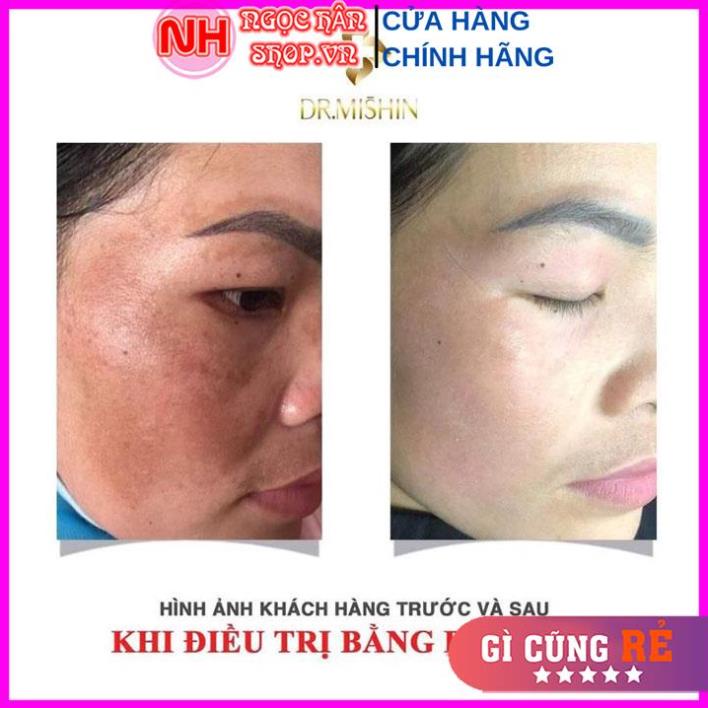 Serum, Tinh Chất,Mỹ phẩm, Bộ kem nám tàn nhang Dr Mishin- Mỹ phẩm chính hãng nhập khẩu Hàn Quốc